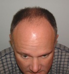 Outta Hair