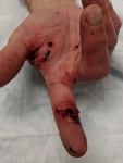 Gnarly