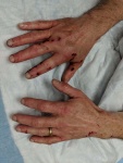 Both Hands